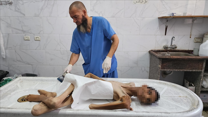 غزة المجوّعة.. الشاب عادل يفارق الحياة بوزن 15 كيلوغراما (تقرير)