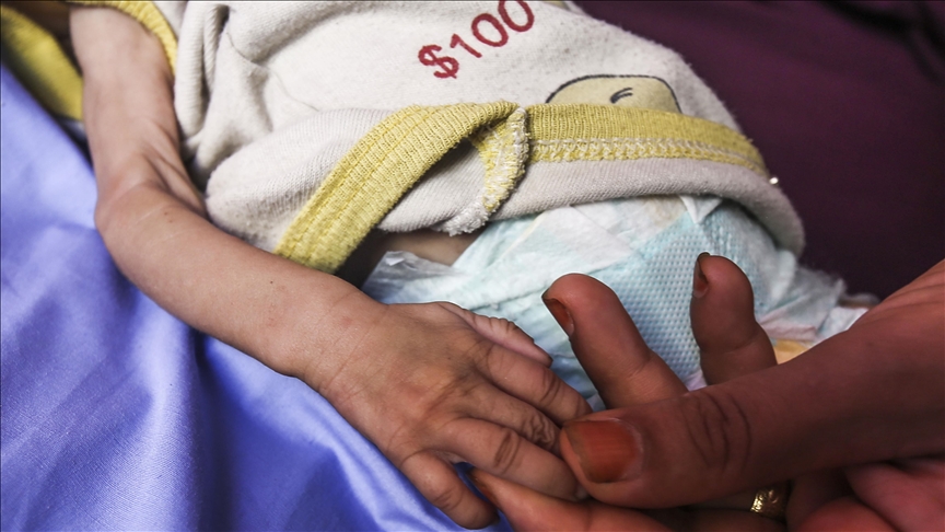 Children in Gaza dying at 'an unprecedented rate': UNICEF