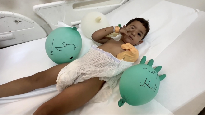 الطفل أحمد.. جائع ومبتور اليد في مستشفى بلا أدوية بغزة (تقرير)