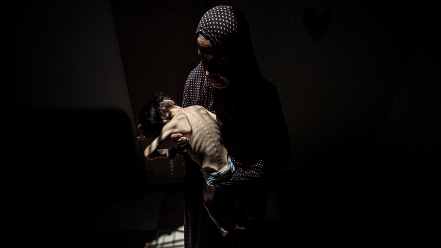 EXPLAINER – US lawmakers ramp up criticism of Israel’s starvation campaign in Gaza