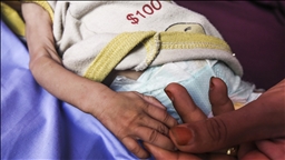 Children in Gaza dying at 'an unprecedented rate': UNICEF