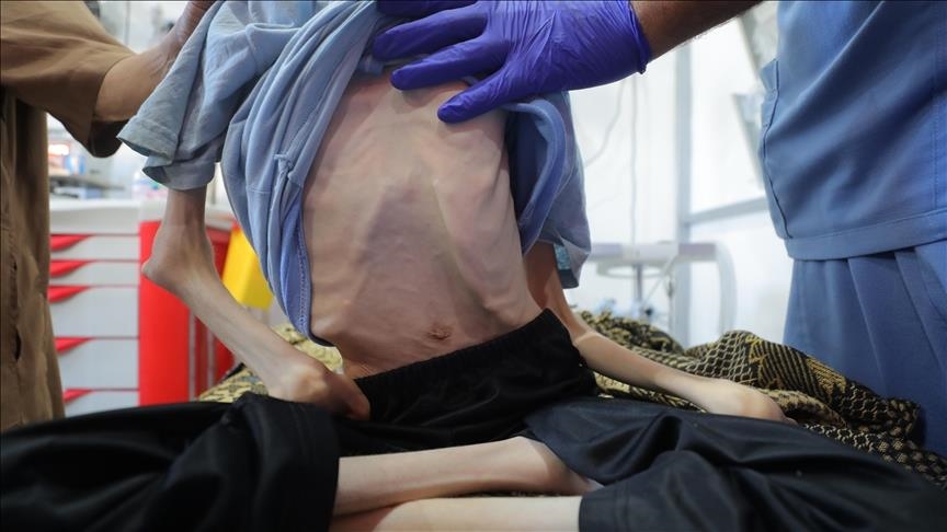 Një adoleshent palestinez vdes nga uria në Gaza për shkak të kufizimeve izraelite të ndihmave