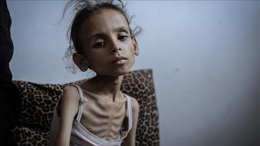 7 more die of starvation in Gaza, taking death toll to 169