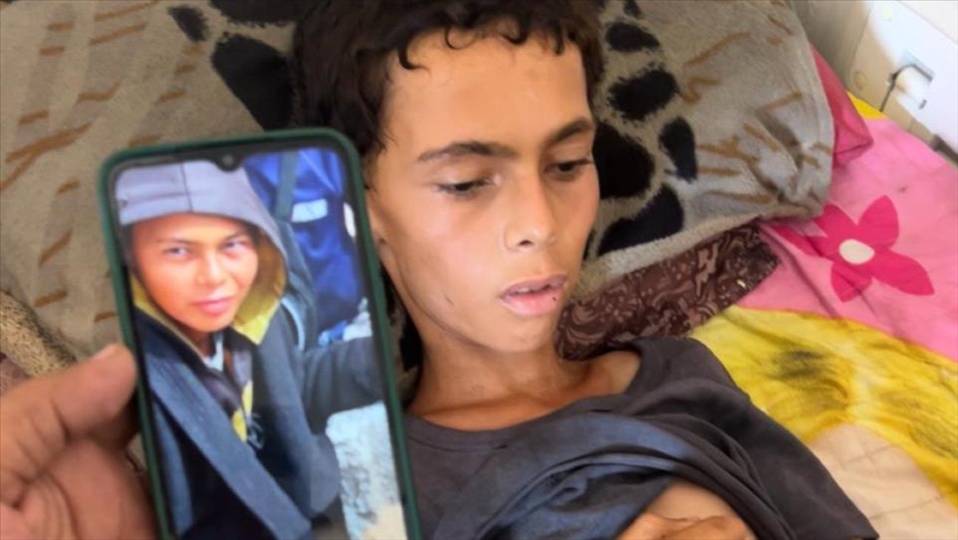 بفعل التجويع الإسرائيلي.. جسد "عاطف" يرحل بوزن 15 كجم فقط