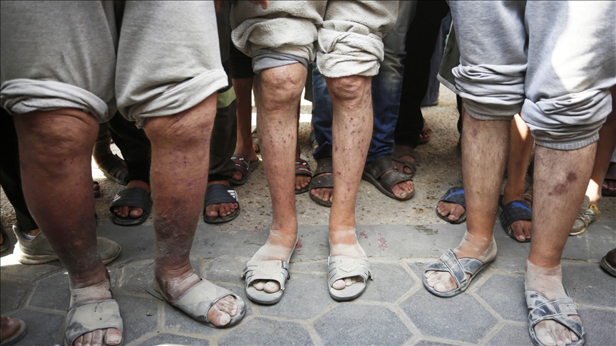 UN hears testimony on torture, abuse of Palestinian detainees by Israeli authorities