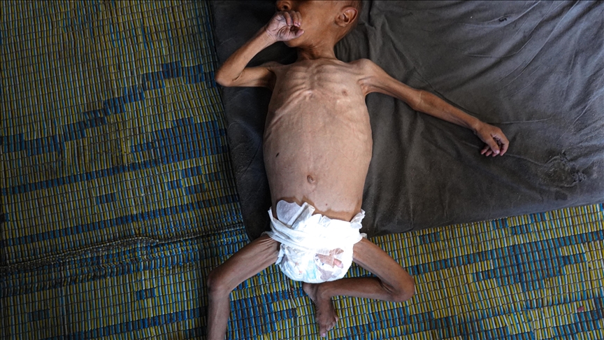 Gaza : 7 nouvelles victimes de la faim, le bilan grimpe à 169 morts (lead)