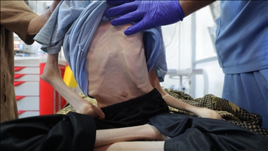Palestinian teen starved to death in Gaza amid Israeli aid restrictions