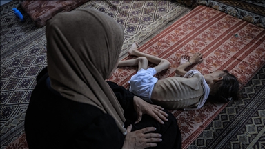 صحة غزة: ارتفاع وفيات التجويع الإسرائيلي إلى 169 بينهم 93 طفلا