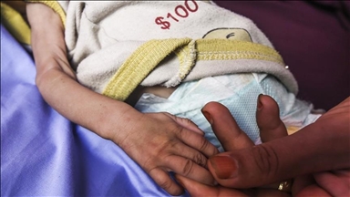 Shtatë palestinezë të tjerë vdesin nga uria në Gaza, shifra e përgjithshme shkon në 169