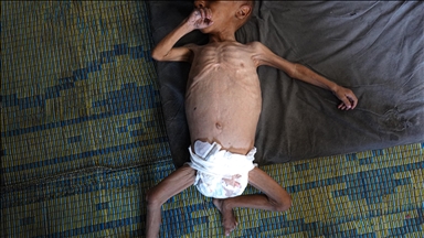 Gaza : 7 nouvelles victimes de la faim, le bilan grimpe à 169 morts (lead)