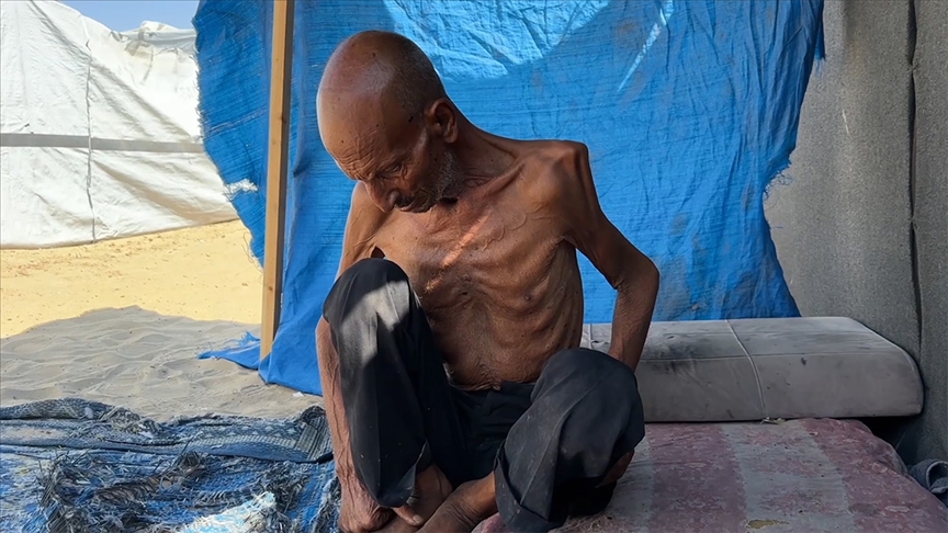 Gazze Şeridi'nde 75 yaşındaki yaşlı adam, İsrail'in dayattığı açlık nedeniyle 40 kiloya düştü