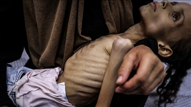 الطفلة مريم.. جسد نحيل أنهكه التجويع الإسرائيلي بغزة
