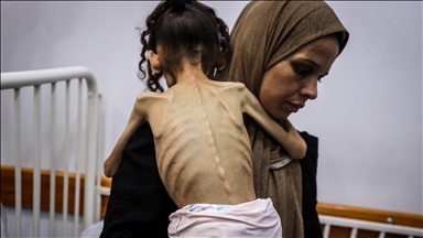 İsrail’in kıtlığa sürüklediği Gazze’de 9 yaşındaki Meryem, 25 kilodan 10 kiloya düştü