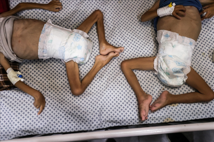 Potresne slike djece suočene s glađu u Gazi: Braća Mehreh bore se za život zbog teške pothranjenosti