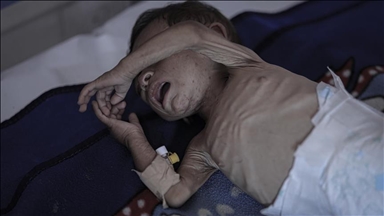 UNICEF desak gencatan senjata segera karena 28 anak tewas setiap hari di Gaza 