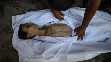 صحة غزة: ارتفاع وفيات التجويع الإسرائيلي إلى 188 بينهم 94 طفلا 