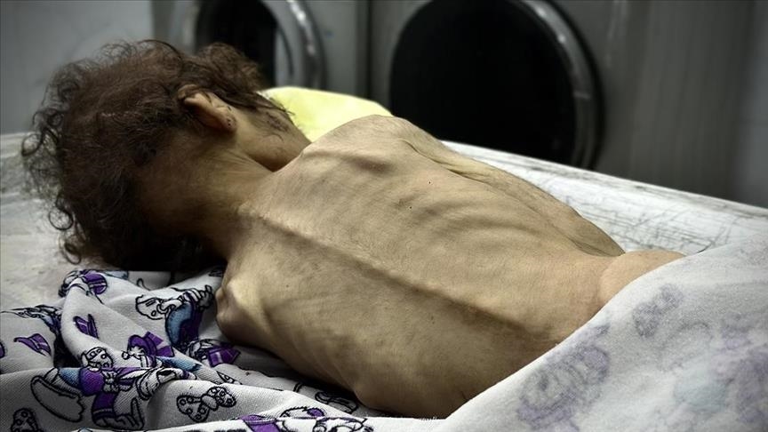 Li Xeta Xezeyê ya ku Îsraîlê xela lê ferz kiriye, di 24 saetên dawîn da 2 jê zarok, 4 kesên din jî ji birçîna mirin