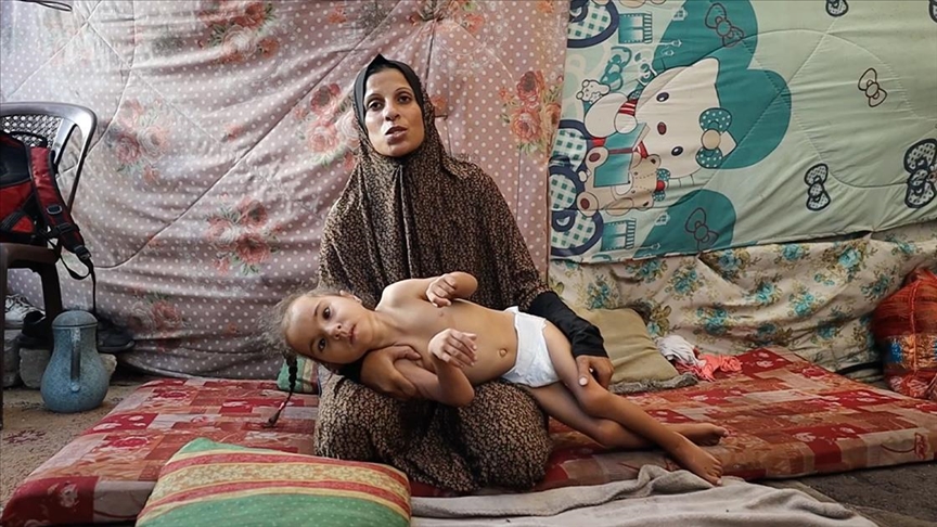 Kequshqyerja kërcënon jetën e një 4-vjeçare në kampin e refugjatëve në Gaza