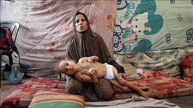 Kequshqyerja kërcënon jetën e një 4-vjeçare në kampin e refugjatëve në Gaza