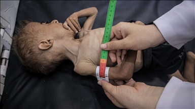 Palestinian doctors warn starving Gaza children could die ‘not in weeks but days’