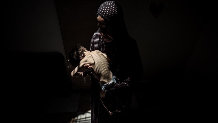 5 palestinezë të tjerë vdesin nga uria gjatë 24 orëve të fundit në Rripin e Gazës
