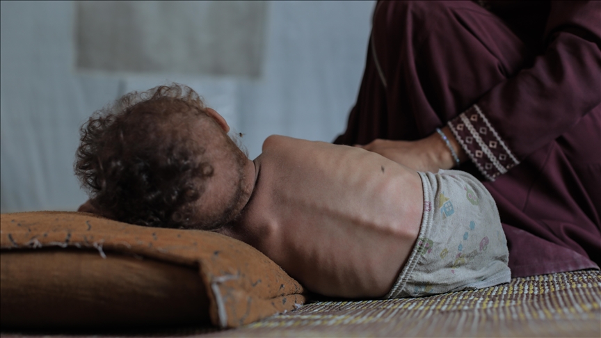 Gazze Şeridi'nde son 24 saatte 2'si çocuk 5 Filistinli daha açlıktan hayatını kaybetti
