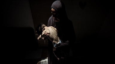 5 palestinezë të tjerë vdesin nga uria gjatë 24 orëve të fundit në Rripin e Gazës