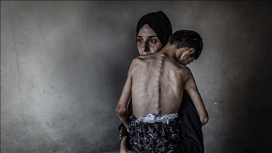 لە غەززە پێنج کەسی دیکە بەھۆی برسێتییەوە گیانیان لەدەستدا