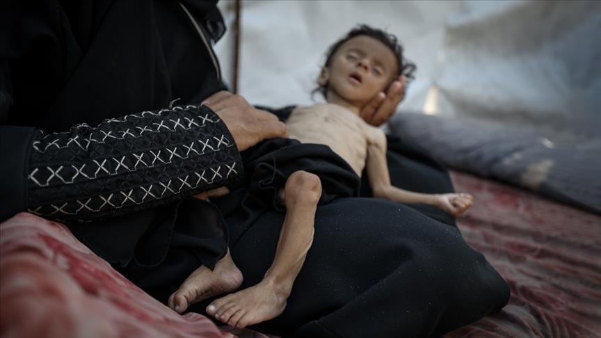 WHO says 148 Palestinians died from malnutrition in Gaza due to Israeli aid blockade