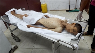 غزة.. وفاة الشاب وسام أبو محسن بسبب التجويع الإسرائيلي
