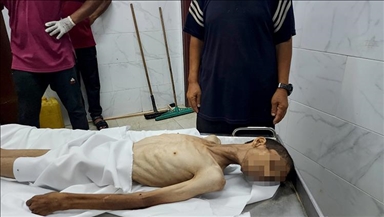 Li Xeta Xezeyê ya ku Îsraîlê xela lê ferz kiriye, di 24 saetên dawîn da 6 kesên din jî ji birçîna mirin