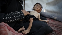 WHO says 148 Palestinians died from malnutrition in Gaza due to Israeli aid blockade