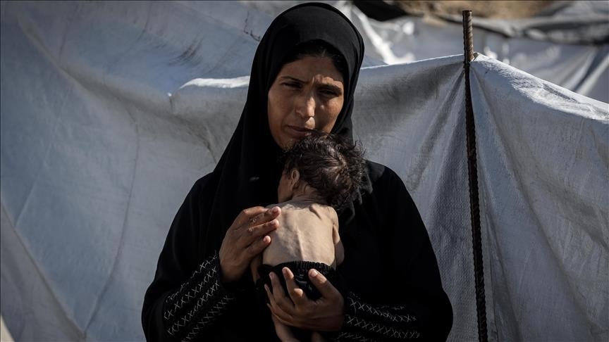 Šef UNRWA: Više od 100 djece umrlo od gladi u opkoljenoj Gazi
