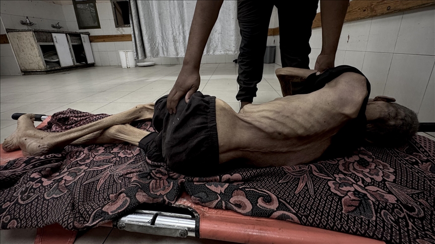 BM: Gazze'de açlıktan ölen insan haberleri sıradan bir olay haline geldi