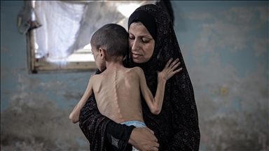 "حكومة غزة": 1.2 مليون طفل بالقطاع يعانون انعدام أمن غذائي حاد 