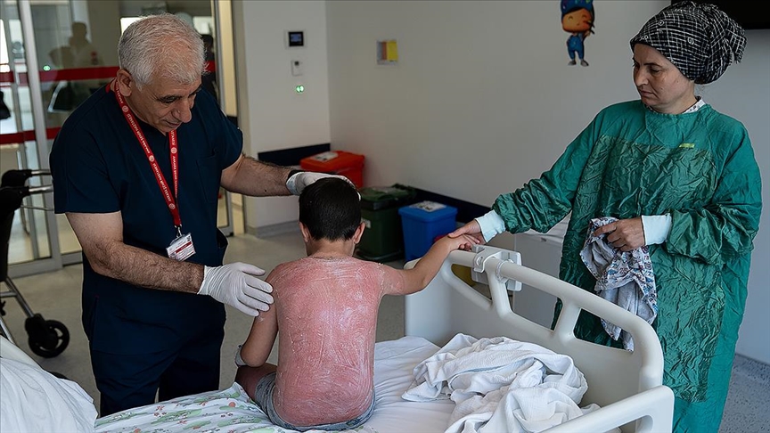 Güneşte 4 saat kalan çocuk, ikinci derece yanıkla hastanelik oldu