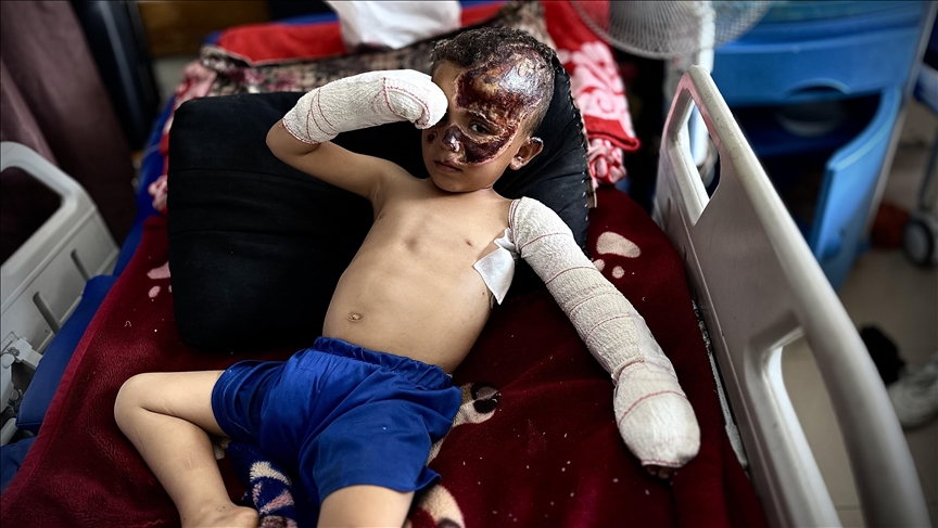 Gazzeli minik Ahmed, İsrail'in saldırısında hem yaralandı hem de yetim ve öksüz kaldı