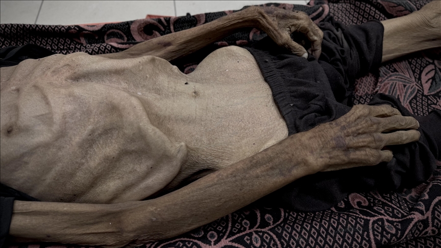 US, European economists, including Nobel laureates, urge Israel to halt Gaza policies worsening starvation