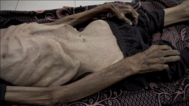 US, European economists, including Nobel laureates, urge Israel to halt Gaza policies worsening starvation