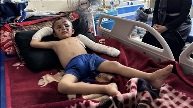 أحمد أبو سحلول.. طفل يواجه الحروق واليتم والجوع في غزة المحاصرة