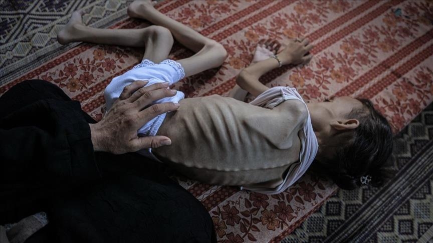 Gaza death toll nears 62,000 as 7 more Palestinians die of starvation