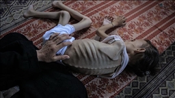 Gaza death toll nears 62,000 as 7 more Palestinians die of starvation
