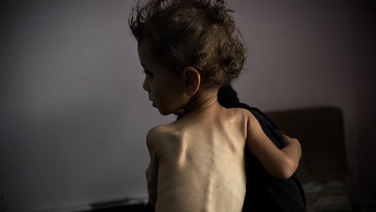 Li Xeta Xezeyê ya ku Îsraîlê xela lê ferz kiriye, di 24 saetên dawîn da 3 kesên din jî ji birçîna mirin