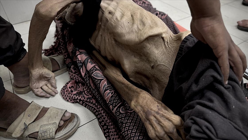 İsrail'in kıtlığı dayattığı Gazze’de açlıktan hayatını kaybedenlerin sayısı 112'si çocuk, 271'e ulaştı