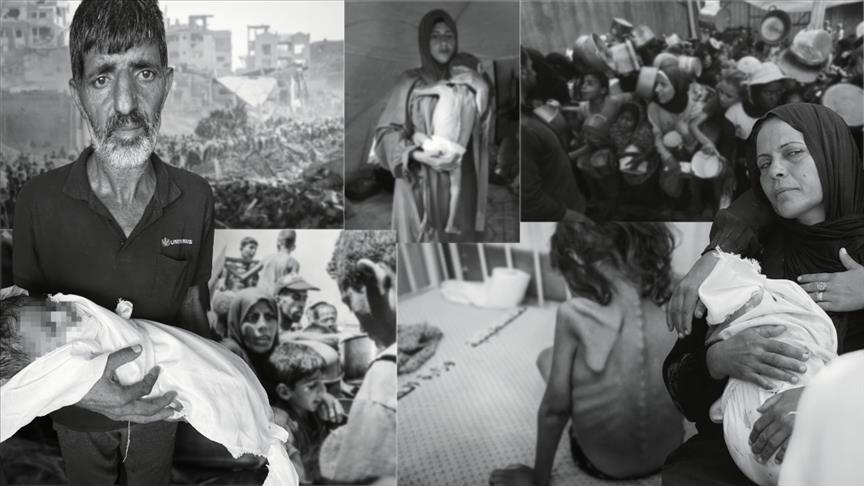 گرسنگی شدید در غزه؛ نوزاد 5 ماهه دیگری جان باخت