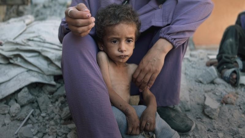 سازمان جهانی بهداشت: تنها امسال 206 نفر در نوار غزه بهدلیل سوءتغذیه جان باختند