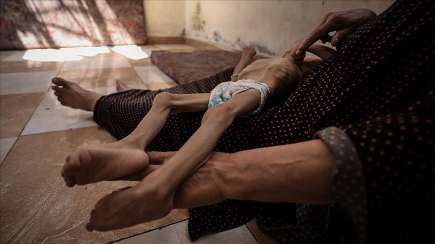 مجاعة غزة.. الكويت تطالب بمحاسبة إسرائيل على جرائمها بحق الإنسانية