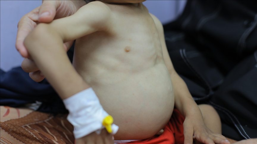 European countries, UN agencies reiterate calls for unimpeded aid after famine confirmed in Gaza European countries, UN agencies reiterate calls for unimpeded aid after famine confirmed in Gaza