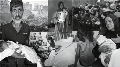 گرسنگی شدید در غزه؛ نوزاد 5 ماهه دیگری جان باخت