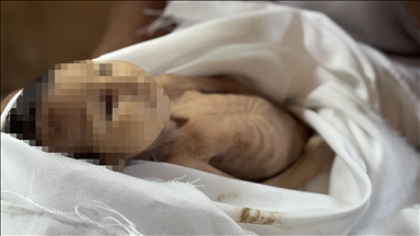 ضحية تجويع.. وفاة الرضيعة غدير بريكة جراء سوء التغذية بغزة 